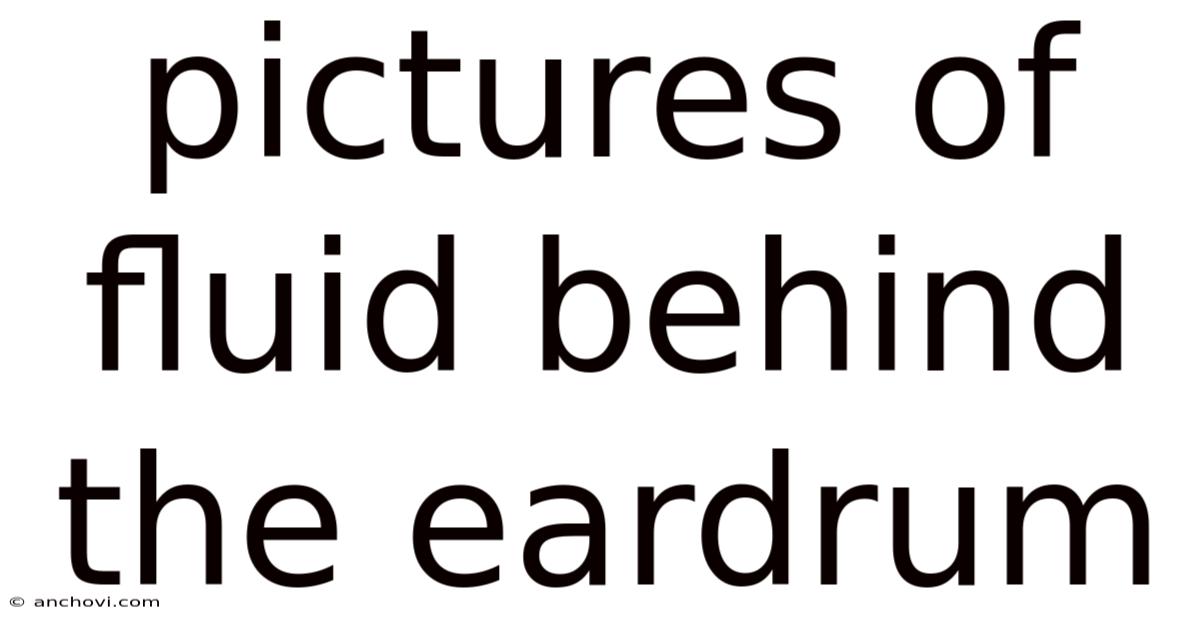 Pictures Of Fluid Behind The Eardrum